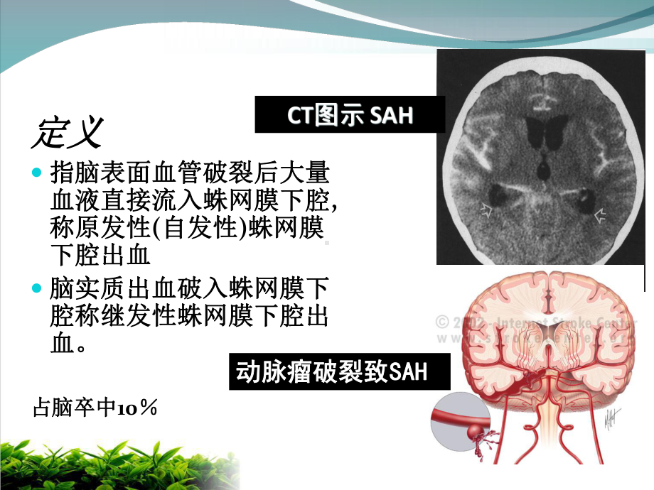 蛛网膜下腔出血诊治流程教材模版课件.ppt_第2页