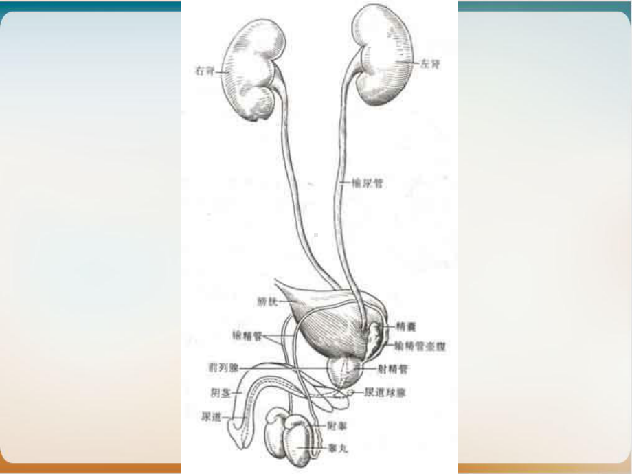 第二节泌尿系统损伤病人的护理课件.ppt_第3页