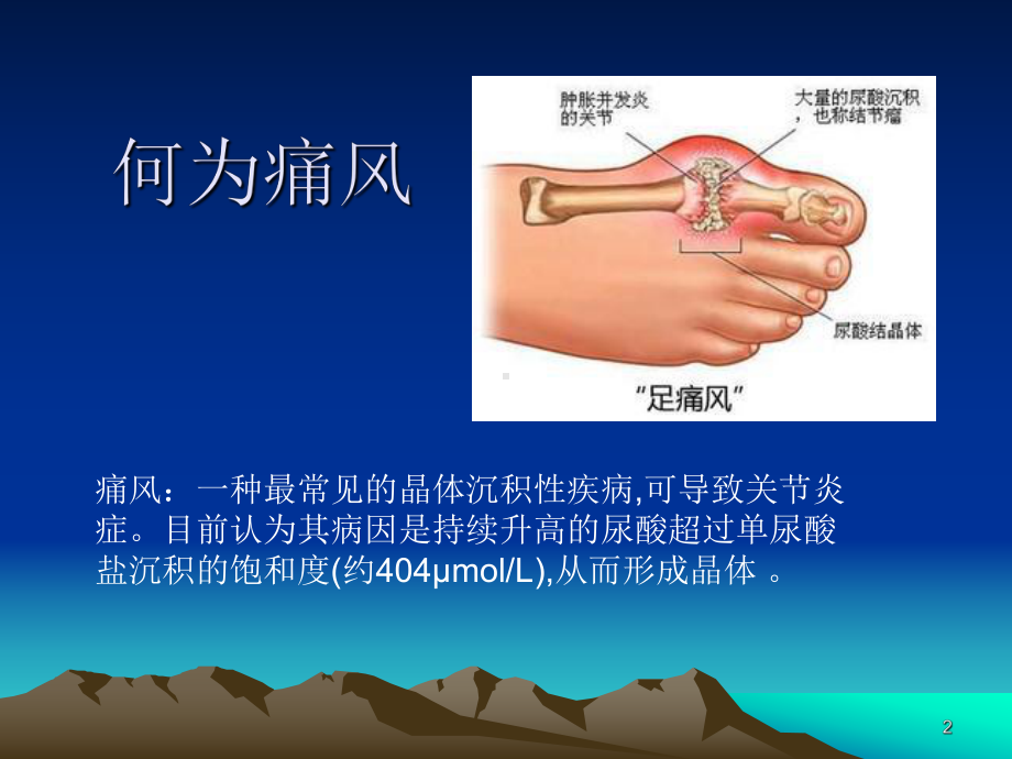 痛风的流行现状及特点课件.ppt_第2页