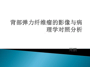 背部弹力纤维瘤的影像与病理学对照分析课件.pptx