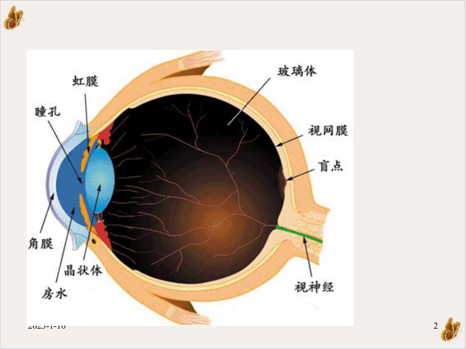 白内障围手术期护理讲义培训课件.pptx_第2页