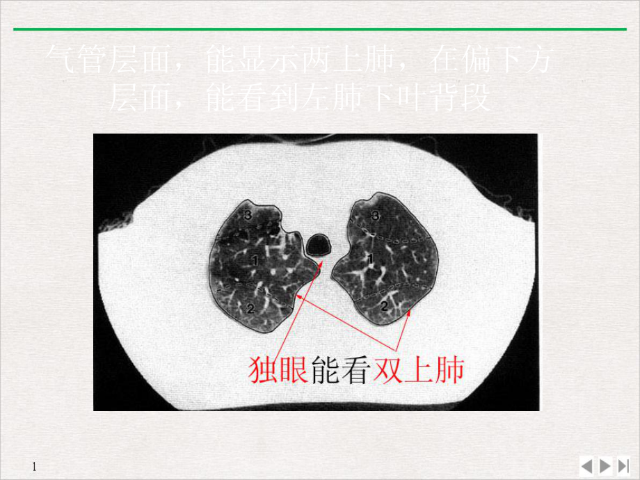 肺部CT分段课件.pptx_第1页