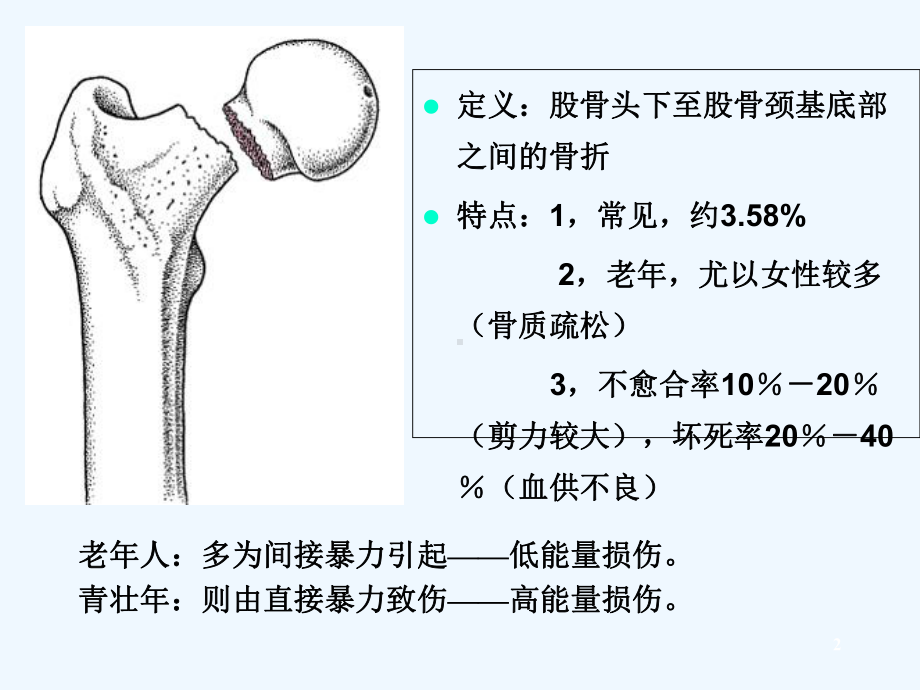 股骨颈骨折治疗选择-课件.ppt_第2页