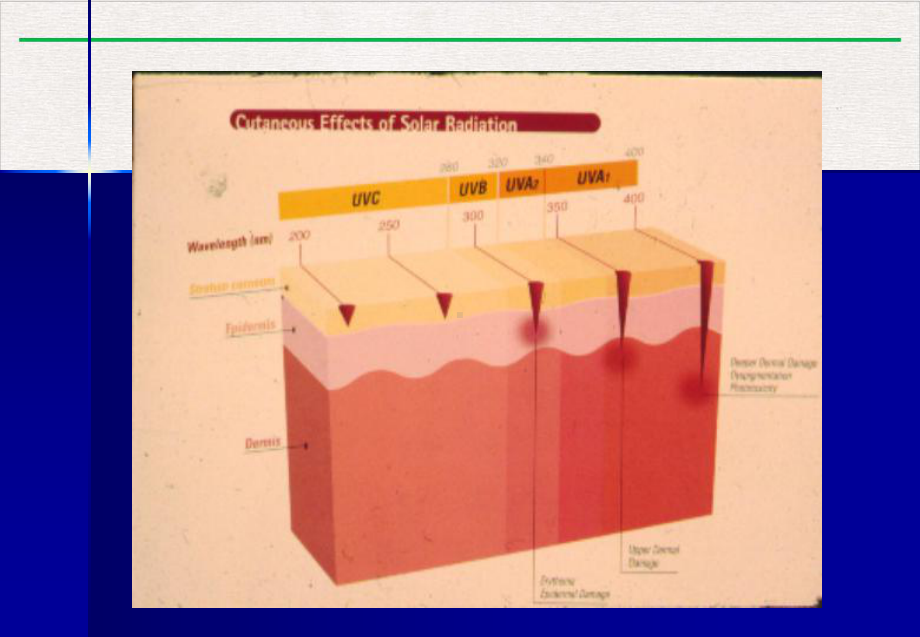 皮肤病的光疗及光化学疗法课件讲义.pptx_第3页