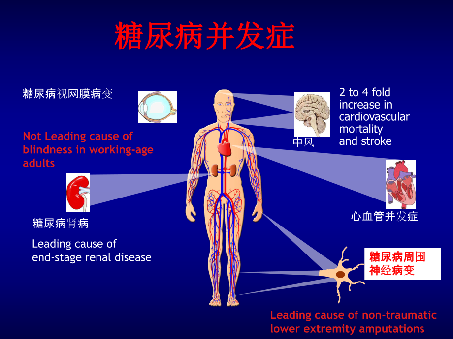 糖尿病神经病变的早期诊治和转化医学研究课件.ppt_第2页