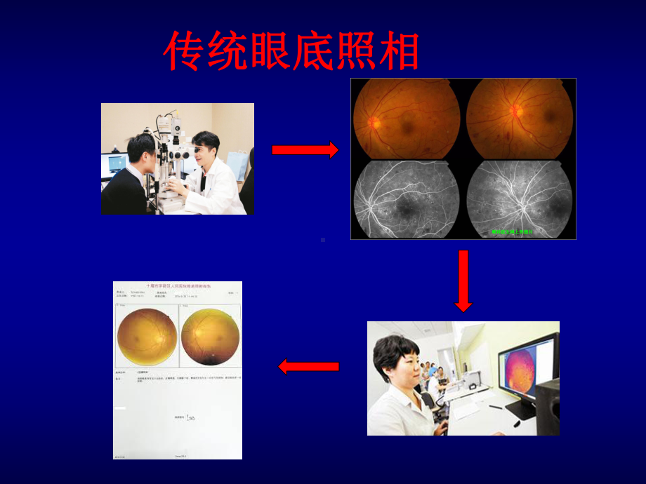 糖尿病神经病变的早期诊治和转化医学研究课件.ppt_第3页