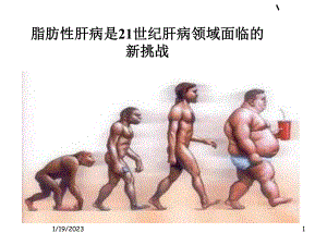 脂肪肝的影像诊断进展课件.ppt