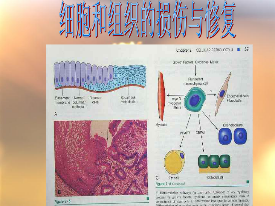 细胞和组织的损伤与修复-课件.ppt_第2页