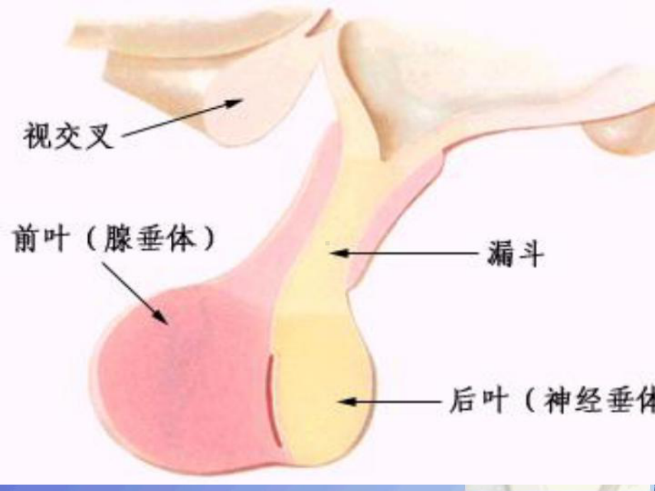 神经外科各论垂体腺瘤课件.pptx_第3页