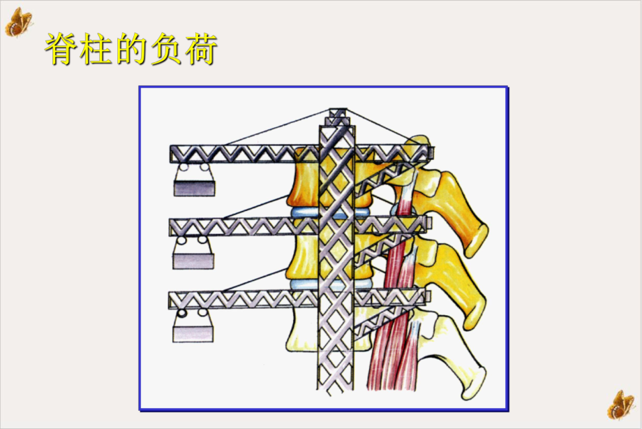 经椎间孔入路腰椎体间融合术PPT课件.pptx_第1页