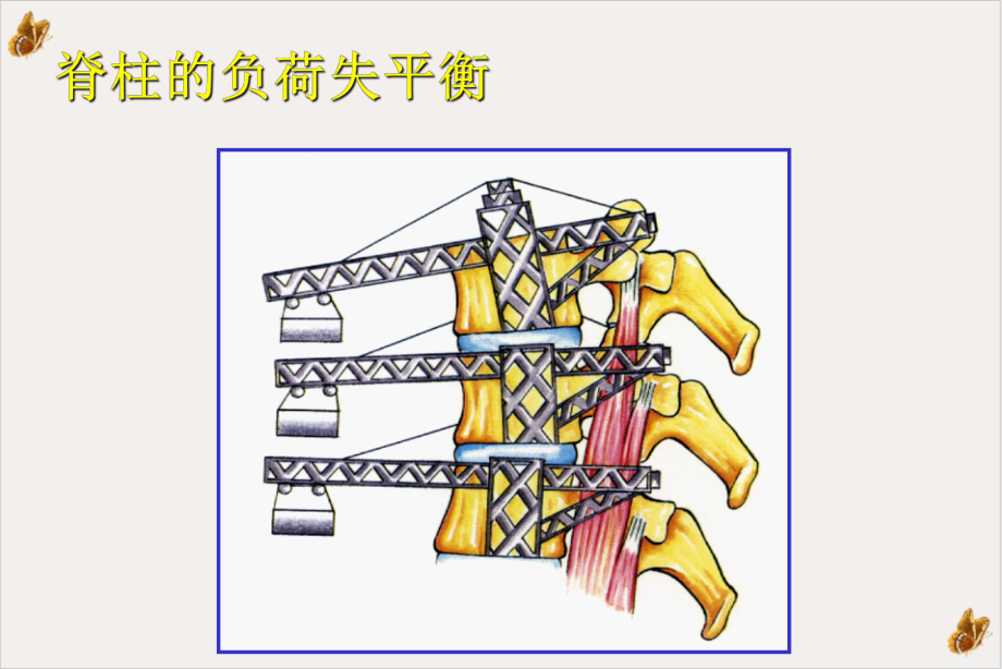 经椎间孔入路腰椎体间融合术PPT课件.pptx_第2页