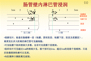 结肠直肠淋巴流向课件.pptx