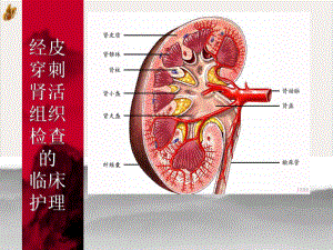 经皮穿刺肾活组织检查的-课件.pptx