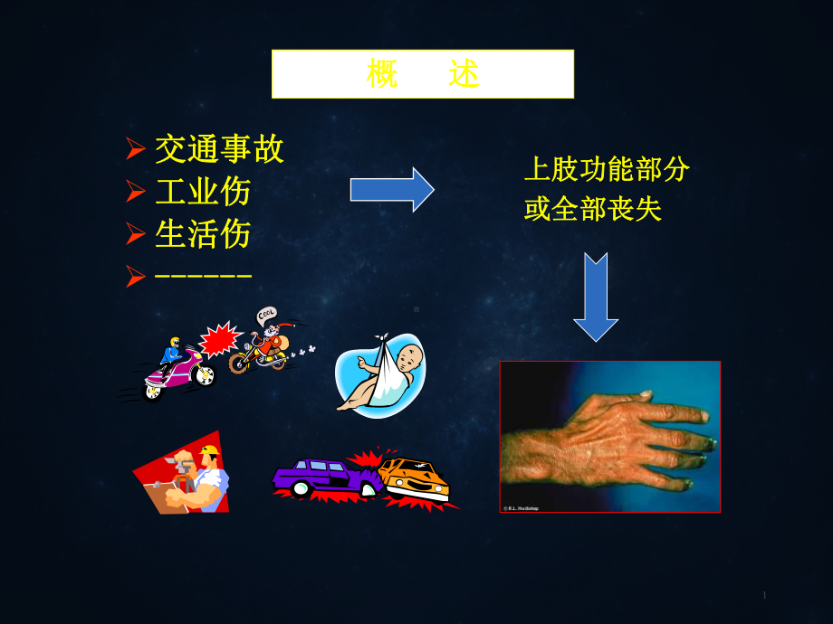 臂丛神经损伤臂丛神经专题课件.ppt_第1页