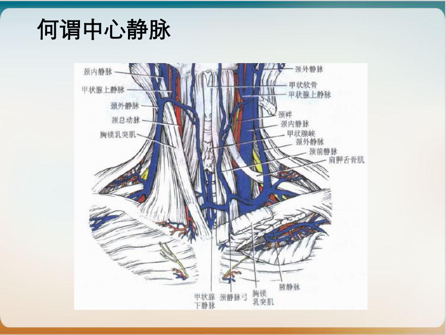 置管与护理实用版课件.ppt_第2页