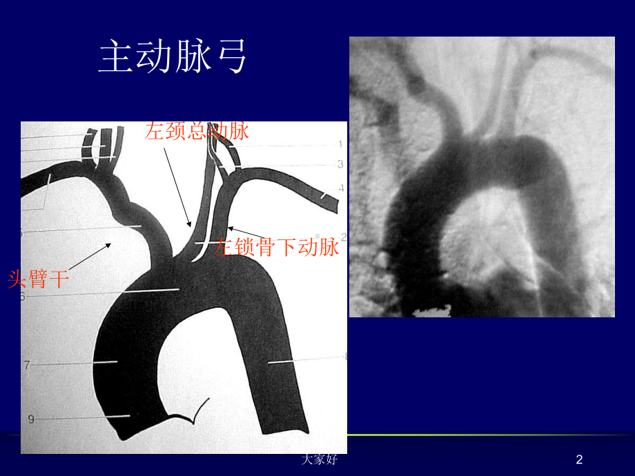 脑血管应用解剖-课件.ppt_第2页