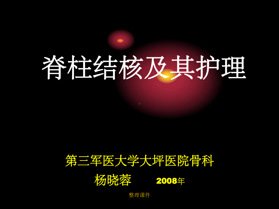 脊柱结核及其护理课件.ppt_第1页