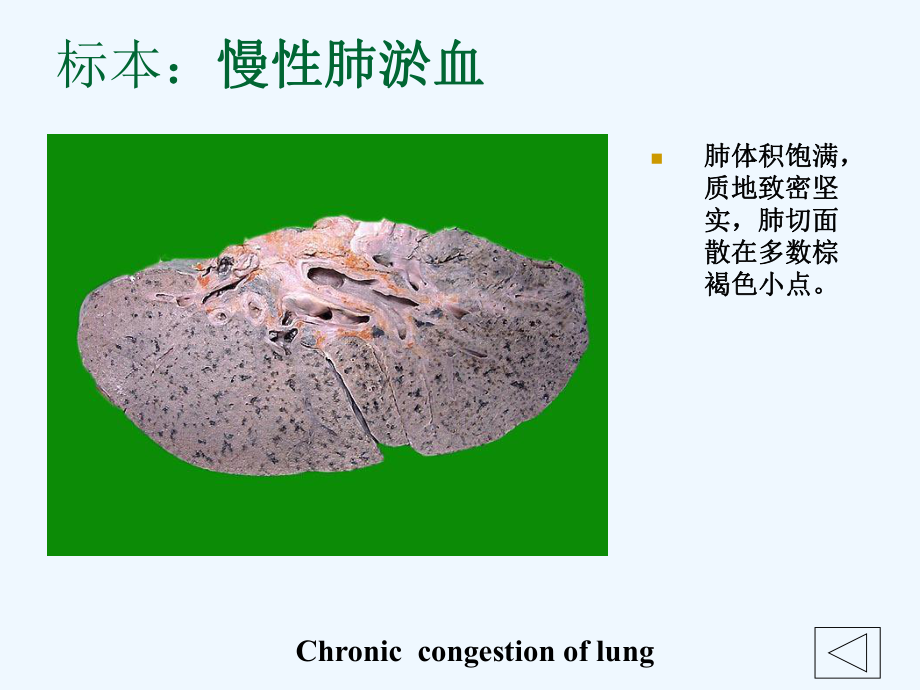 病理学实验大体标本有病理诊断课件.ppt_第1页