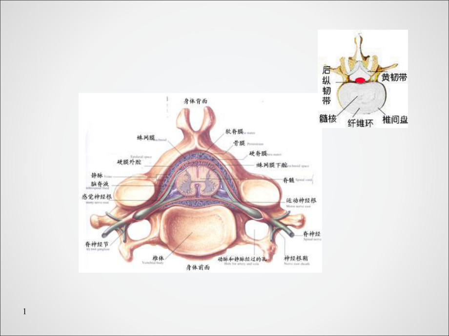 腰椎间盘突出症病人的护理-课件.ppt_第2页