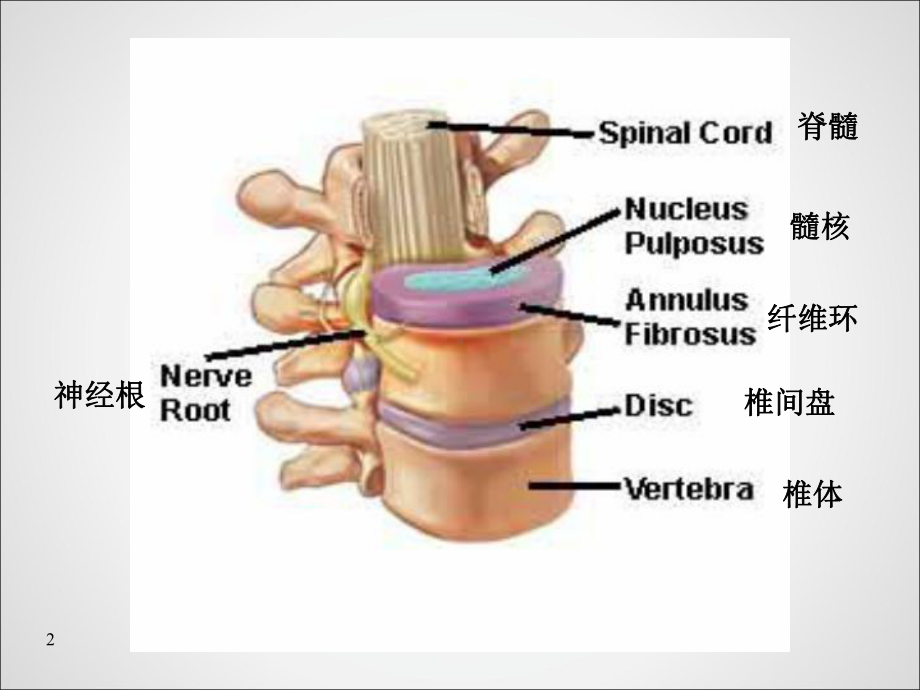 腰椎间盘突出症病人的护理-课件.ppt_第3页