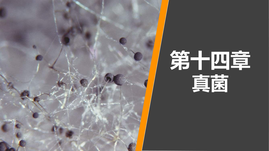 病原生物学与免疫学-第十四章课件.ppt_第1页