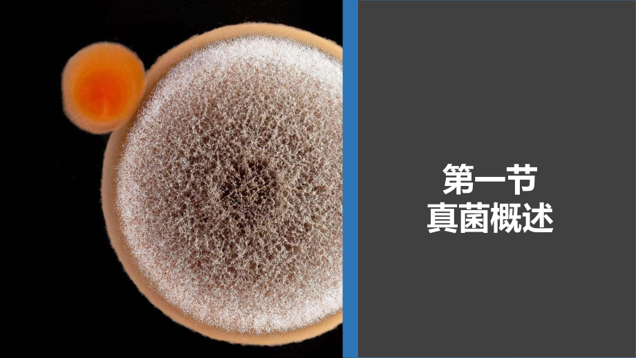 病原生物学与免疫学-第十四章课件.ppt_第2页