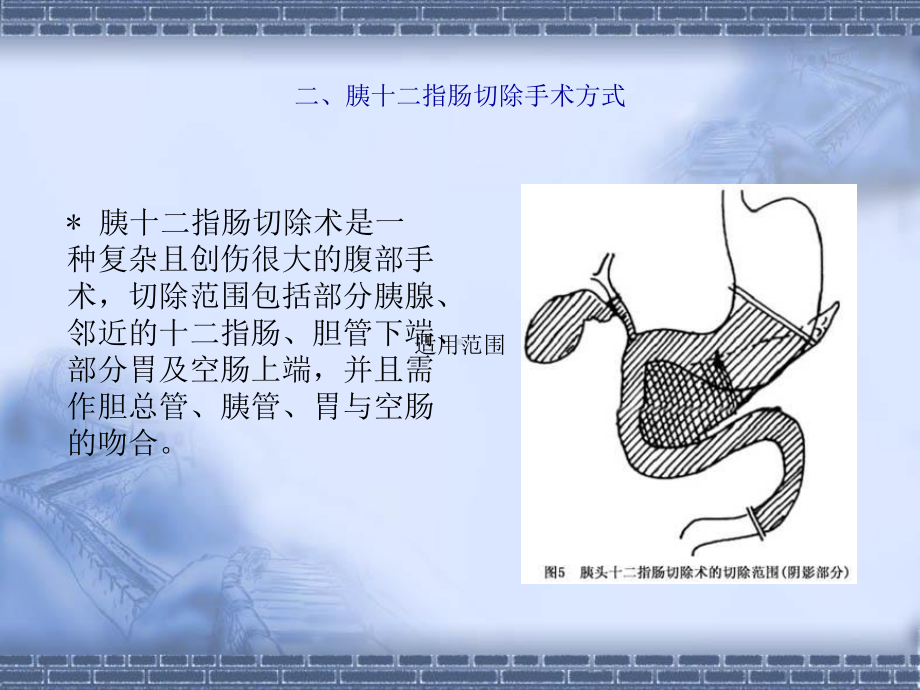 胆囊切除-胰十二指肠切除术后护理课件.ppt_第3页