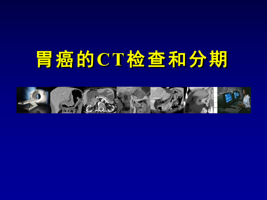 胃癌的CT检查和分期课件.ppt_第1页