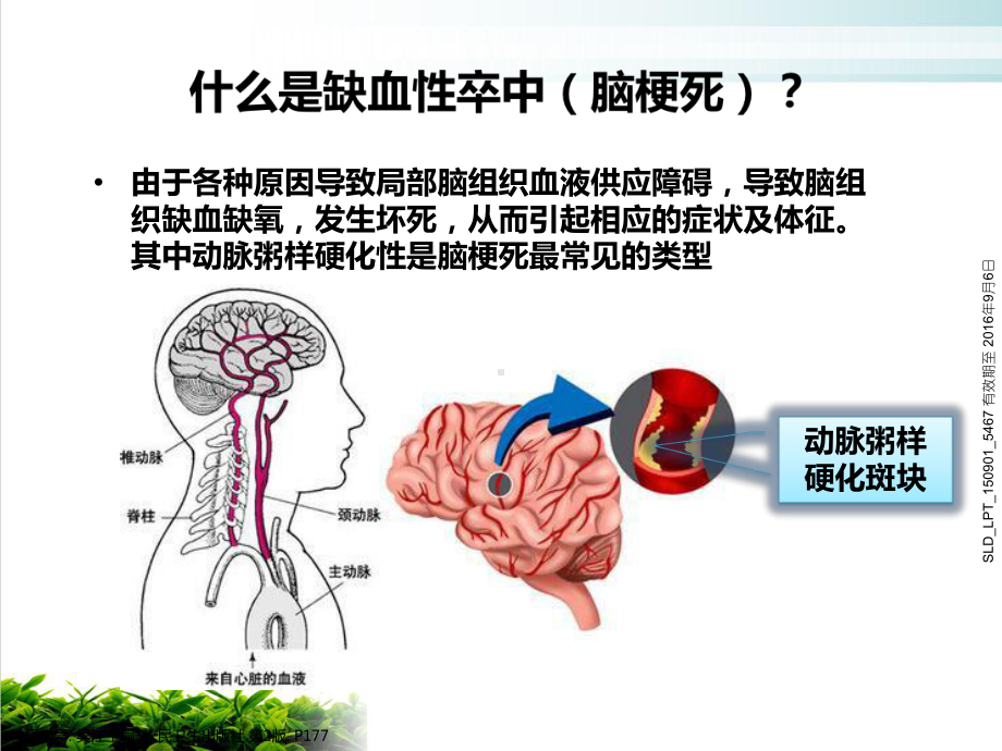 缺血性卒中患者教育病房课件.pptx_第2页