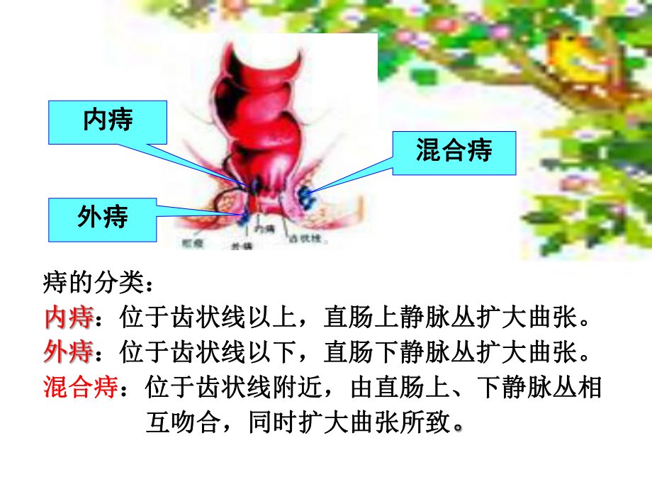 直肠肛管疾病病人的护理模板课件.pptx_第2页