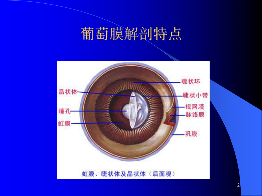 葡萄膜疾病课件.ppt_第2页