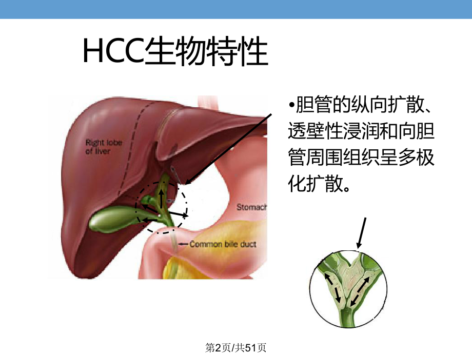 肝门胆管癌淋巴结NEW课件.pptx_第2页