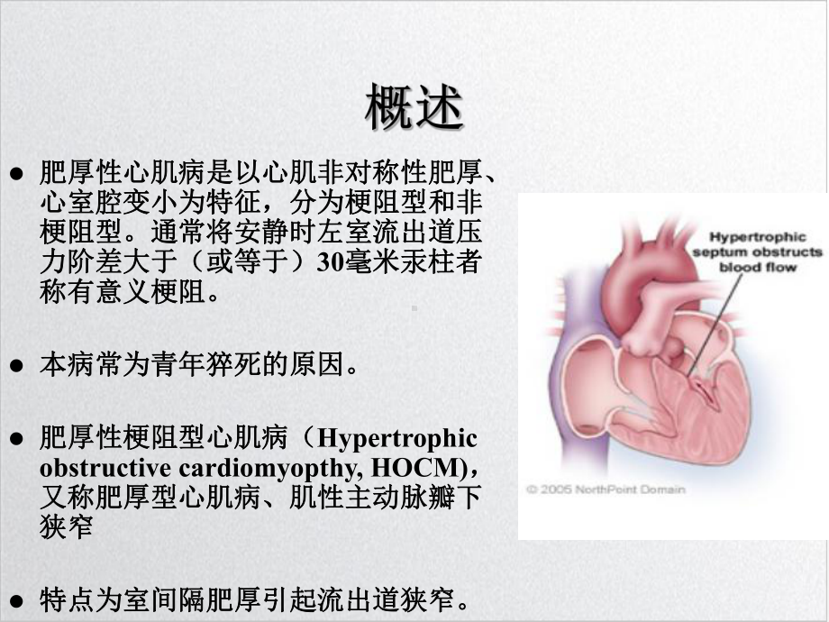 肥厚型梗阻性心肌病与麻醉课件整理.ppt_第3页