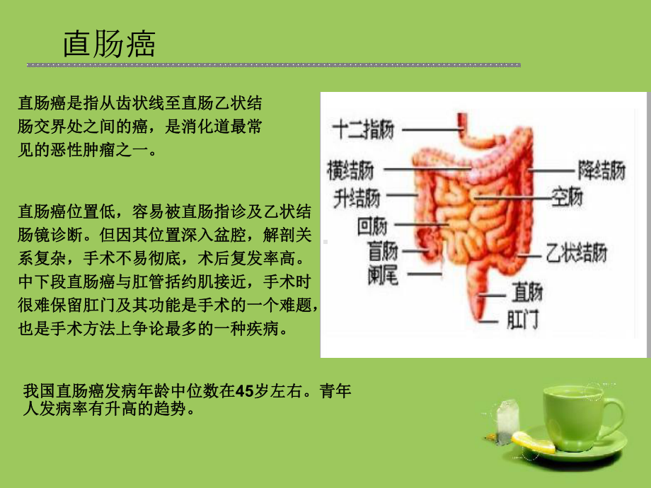 直肠癌患者的病例分析课件.ppt_第3页