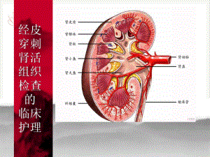 经皮穿刺肾活组织检查的PPT课件.pptx