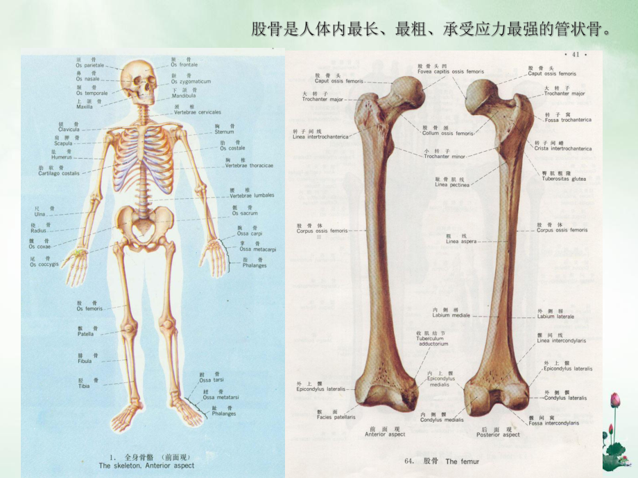 股骨骨折护理及痿证讲课课件.ppt_第3页