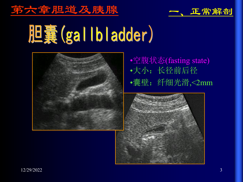 胆道及胰腺超声课件.ppt_第3页