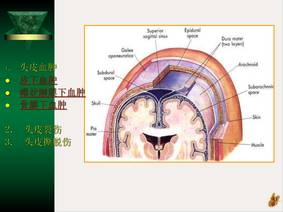 神经外科学课件.pptx_第2页