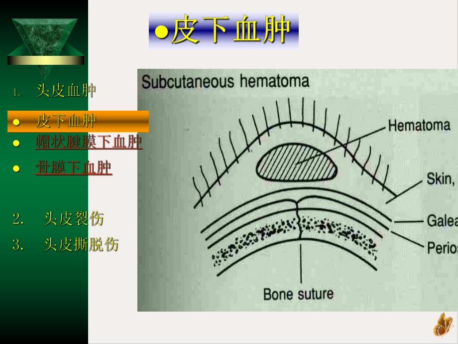 神经外科学课件.pptx_第3页