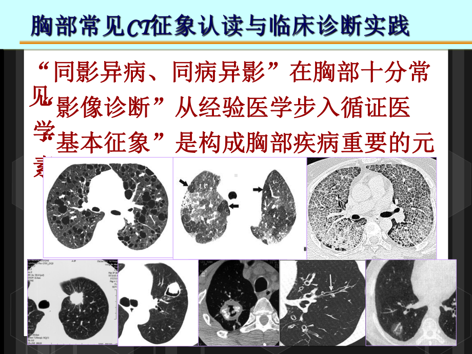 胸部常见疾病CT表现课件.ppt_第2页