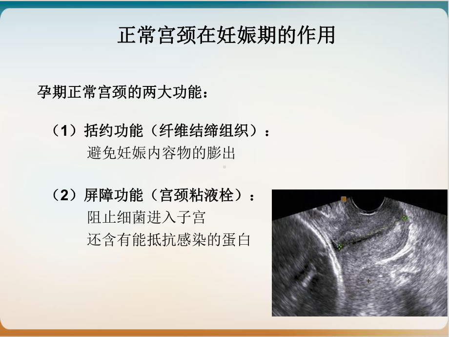 紧急宫颈环扎术的手术指征及术后管理课件.ppt_第3页