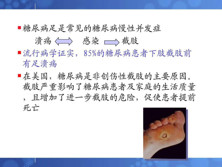 糖尿病足的护理课件(同名391).ppt_第2页