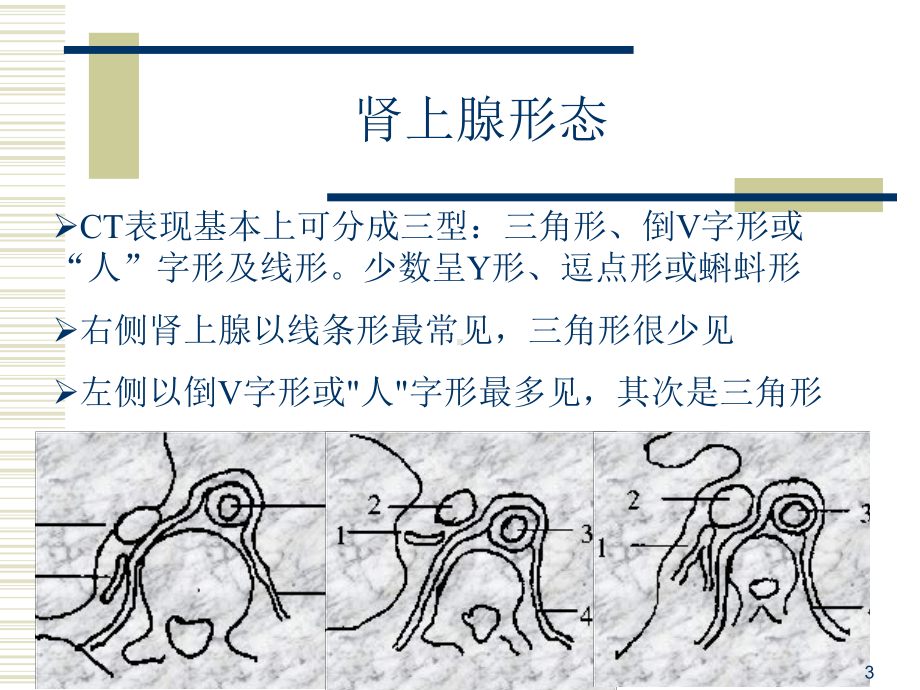 肾上腺皮质腺瘤CT表现课件.ppt_第3页