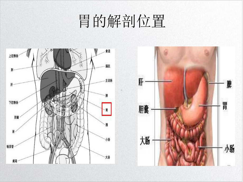 胃癌仓梅实用版课件.ppt_第3页