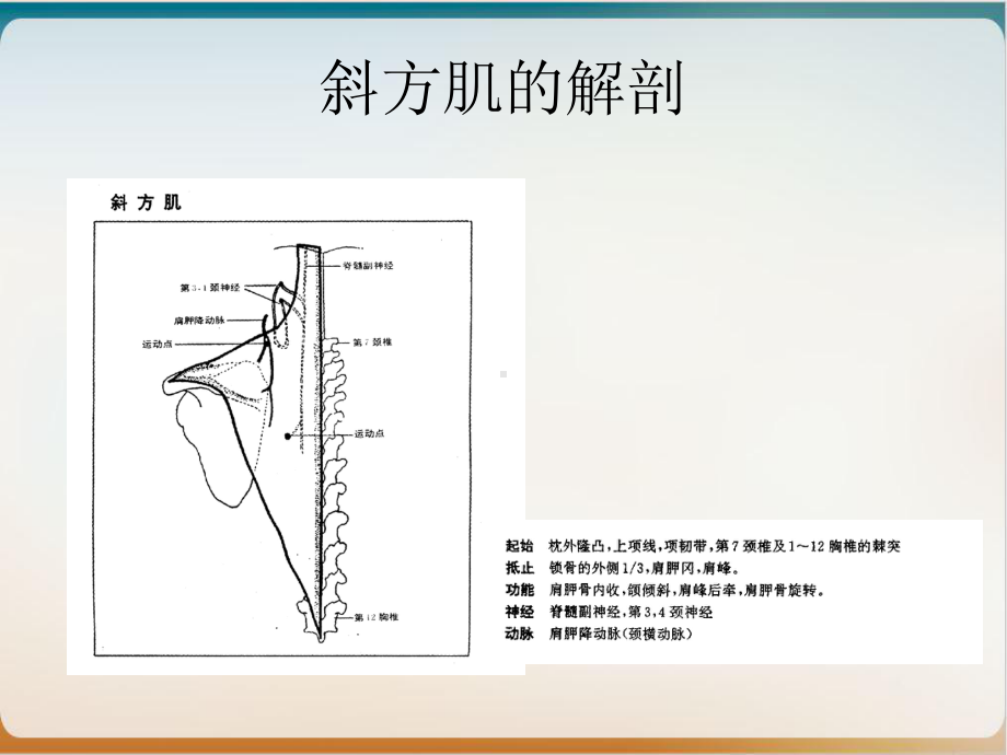 肌筋膜激痛点治疗斜方肌优质课件.ppt_第3页