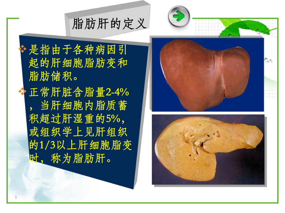 脂肪肝健康宣教课件.ppt_第3页