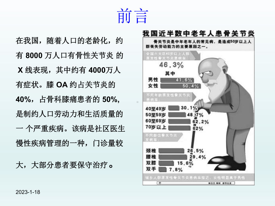 膝关节骨性关节炎课件整理.ppt_第2页