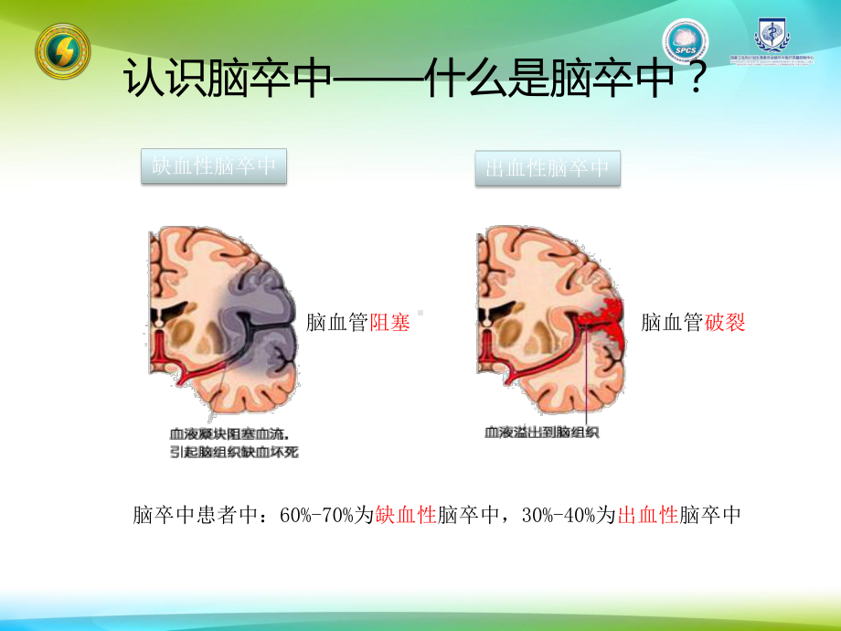 神经内科血压篇培训课件.pptx_第3页