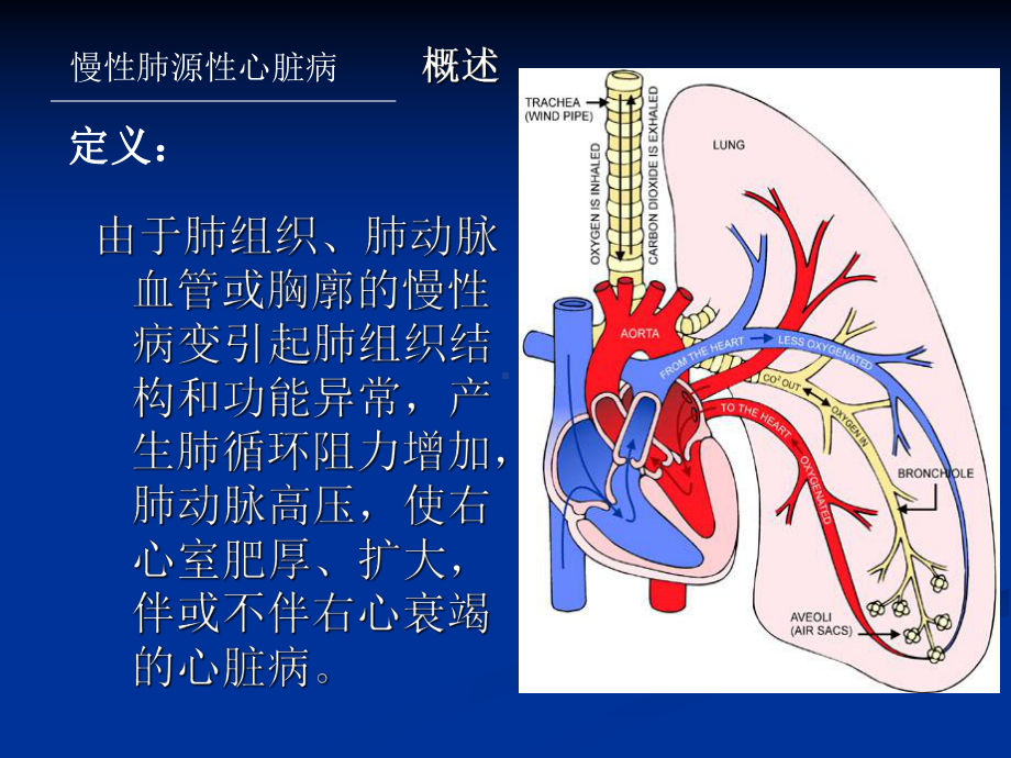 肺心病(内科学)课件.ppt_第3页