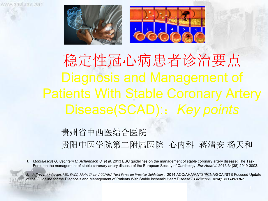 稳定性冠心病诊治要点课件.pptx_第1页